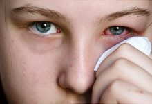 Photo of 10 SIGNS YOU HAVE A BAD EYE