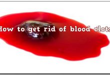 Photo of HOW TO GET RID OF BLOOD CLOT NATURALLY
