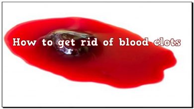 Photo of HOW TO GET RID OF BLOOD CLOT NATURALLY