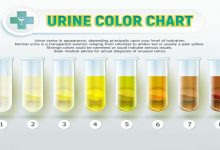 Photo of WHAT THE COLOR OF YOUR URINE SAYS ABOUT YOUR HEALTH:That You Don’t Know