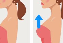 Photo of EASIEST WAY TO FIRM SAGGY BREAST
