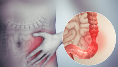 Photo of 6 NATURAL REMEDY FOR IRRITABLE BOWEL SYNDROME (IBS)