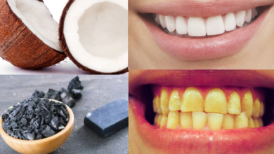 Photo of 7 WAYS TO GET WHITE TEETH IN 7 DAYS
