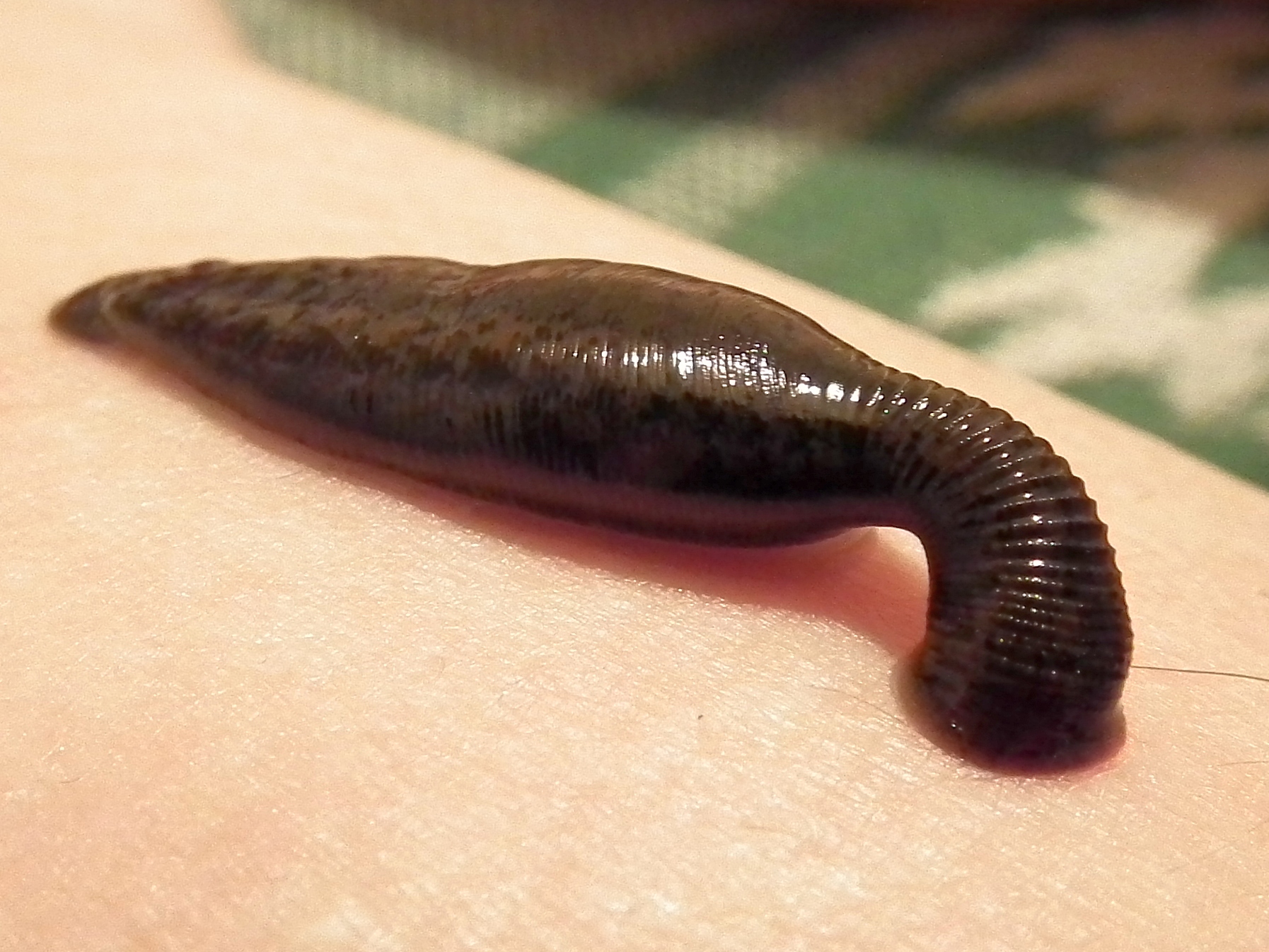 Photo of Shocking Benefits of Leech You Must Know