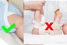 Photo of 7 Side Effects of Diapers on Babies