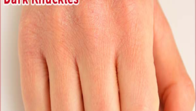Photo of EASY WAY TO REMOVE DARK KNUCKLES OVERNIGHT