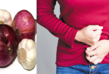 Photo of ONION-GARLIC COMBO FOR QUICK FIBROID SHRINKING