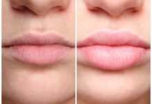 Photo of NATURAL WAYS TO MAKE YOUR LIPS PINK IN 4 DAYS